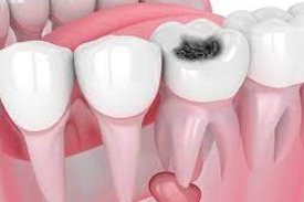 dental clinic in chandigarh