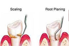 dental clinic in chandigarh