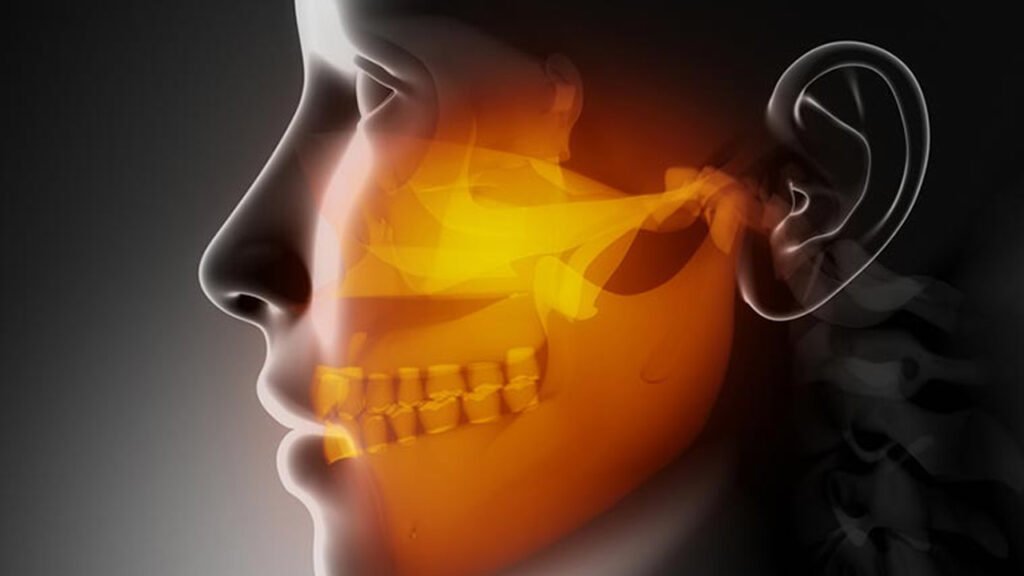 Temporomandibular-Joint-(TMJ)-Disorders